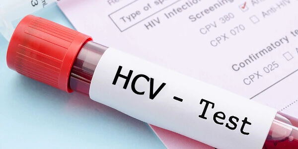 HCV-test Тест на гепатит С